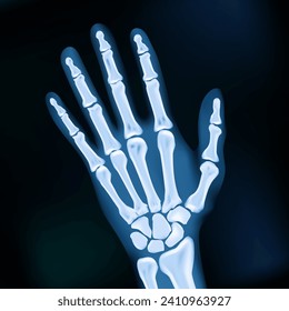 Realistic X-ray Hand Medical Image. EPS10 Vector