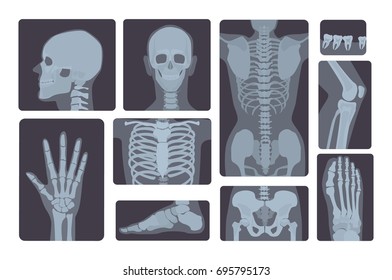 Realistic x-ray shots collection. Human body:  hand, leg, skull, foot, chest, teeth, spine and other.
