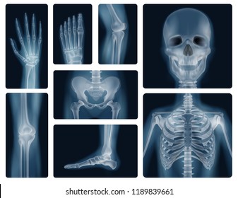 Realistic x-ray shots of human bones of skull pelvis thorax knee and limbs isolated vector illustration  