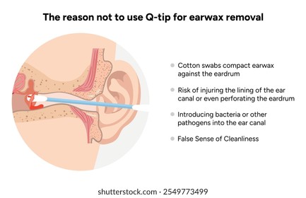 The reason not to use q-tip for earwax removal. Medical information