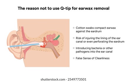 The reason not to use q-tip for earwax removal. Medical information