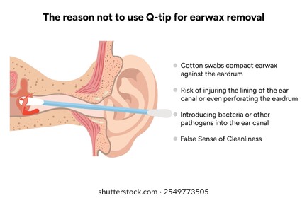 The reason not to use q-tip for earwax removal. Medical information