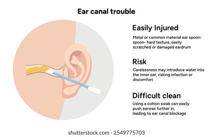 The reason not to use q-tip for earwax removal. Ear canal trouble. Medical information