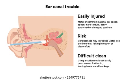 The reason not to use q-tip for earwax removal. Ear canal trouble. Medical information