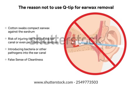 The reason not to use q-tip for earwax removal. Medical information