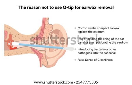 The reason not to use q-tip for earwax removal. Medical information