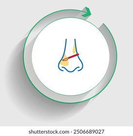 Wiederherstellung von Septumplastik mit FESS