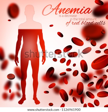 Red blood cells background. Iron deficiency anemia image. Medical and healthcare concept with a human figure in pink and red colors. Editable vector illustration.