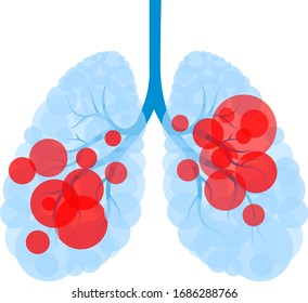 Red circle in human lung shape. Lung  disease with virus. Virus cells eating lung. Damaged lung with coronavirus. Lllustration on white background.