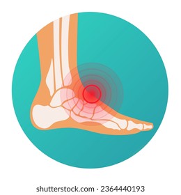 Red circle pain localization in human foot, foot injury, skeleton, joints and bones