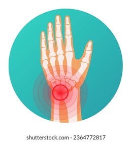 Red circle pain localization in human hand wrist injury, skeleton, joints and bones vector - Shutterstock ID 2364772817