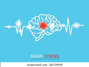  red epicenter of the pain of brain