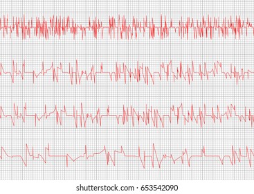 Red Heart cardiogram vector charts set. Healthy heart rhythm