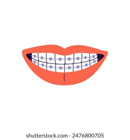 Red lips with braces on healthy smile. Mouth with orthodontic apparatus on clean teeth. Oral health care, dental hygiene. Dentistry, stomatology. Flat isolated vector illustration on white background