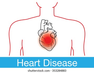 Red point happens on heart in human body meaning heart disease. Medical illustration in outline version.