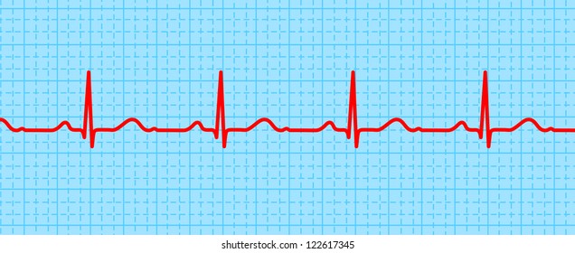 Red pulse on blue background with grid