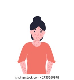 Red rash is all over body. Flat vector cartoon modern illustration. 