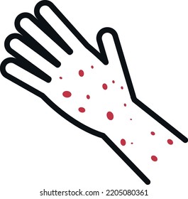 Red rash on human hand. Disease symptom icon