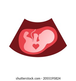 rotes Ultraschallbild des Fötus. Konzept des Babys bei Gebärmutter, Schwangerschaft und Gesundheit, Untersuchungsverfahren des Embryos, Plazenta, Nabelschnur. Emblem für das Gestationszentrum. einfaches Schild auf Weiß