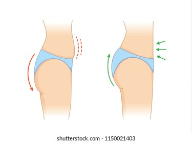 Reduce fat and cellulite at buttock and abdomen for beauty shape in side view. Illustration about body care.