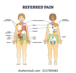 Referred pain location as body painful stimulus organ origin outline diagram. Labeled educational chart with problem zones projection vector illustration. Internal medical disease diagnostics map.