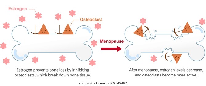 Relationship between the female hormone estrogen and osteoporosis