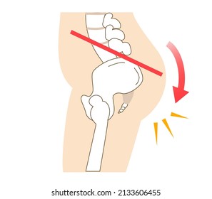 Relationship Between Pelvic Tilt And Posture
