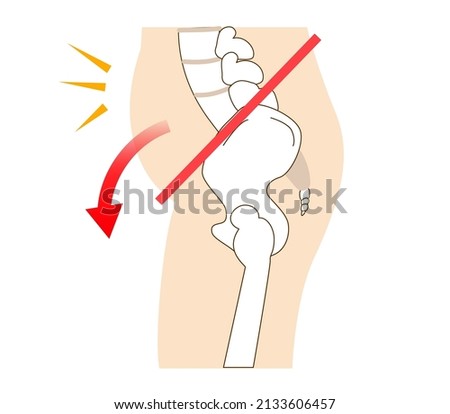Relationship between pelvic tilt and posture

