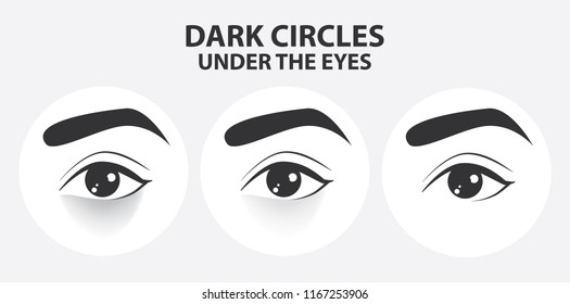 Removal Of Dark Circles Under The Eyes Vector Illustration 