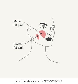 Removal of malar fat pad and buccal fat pad. Antiaging facelift with plastic surgery. Plastic surgery illustration