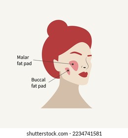 Removal of malar fat pad and buccal fat pad. Antiaging facelift with plastic surgery. Plastic surgery illustration