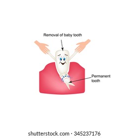 Removing baby teeth. Children's cartoon style. Infographics. Vector illustration on isolated background.