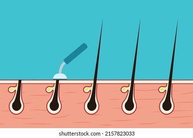 Removing body hair with a shaver concept vector. Shaving hair from the skin with a shaver blade illustration. Facial or body haircutting concept with human skin and shaver blade vector.