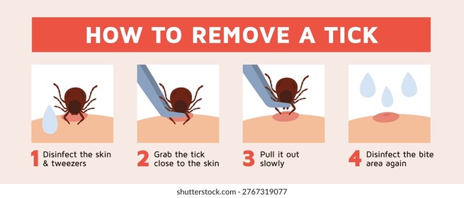 Removing tick. Step by step instructions for removing stuck insect, detection parasite, peddler of serious diseases, medical infographic poster, garish vector cartoon flat style isolated concept