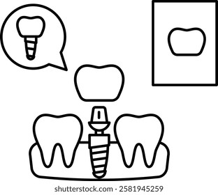 Replacing one Missing Teeth using Dental Implant Concept, permanent fixed dentures replacement vector icon design, Dentistry symbol, Healthcare sign, Dental instrument illustration