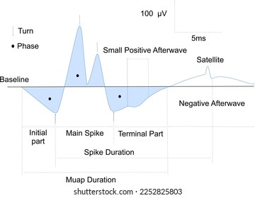 Representation of an electromyographic signal , MUAP , EMG signal,  EMG wave