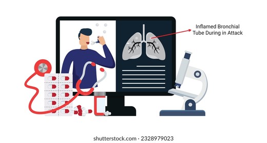 Respiratory system disease. Breathing problems. Airway disease. vector