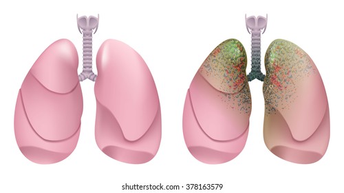 Respiratory system. Lung, larynx and trachea. Isolated on white illustration