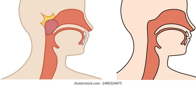respiratory tract, human, breathing -  flat illustration 