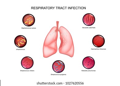 respiratory tract infection