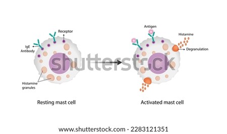 Resting and activated mast cell. Anaphylactic, allergic reaction, Autoimmune disorders, allergy and anaphylaxis. IgE antibodies are in involved in Anaphylactic reaction. Vector illustration.