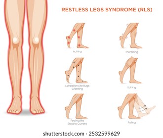 El síndrome de las piernas inquietas (RLS, por sus siglas en inglés) causa una necesidad incontrolable de mover las piernas, a menudo acompañada de sensaciones incómodas, especialmente por la noche.