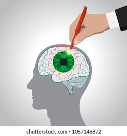 Restoration of brain functions, prosthetics of affected areas, mind, consciousness, memory, surgical treatment of brain diseases