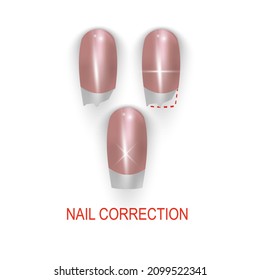 Restoration of a broken nail, nail salon, vector illustration