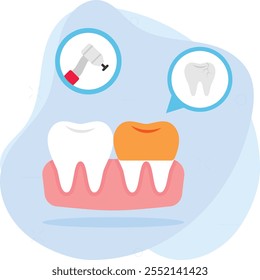 Odontología restaurativa o concepto de rellenos dentales, extracción y aplicación de la corona en el diseño de íconos de color del Vector de dientes, símbolo del dentista, signo de atención médica, ilustración de instrumentos dentales