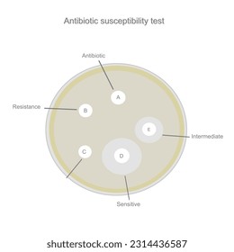 Ergebnis des Antibiotikaresistenztests: Resistenz, Sensitive Bakterien und Pilze mit Zwischenwirkung, die eine Inhibitionszone um das Paddel antimikrobiell wirkender Arzneimittel (A, B, C, D, E) aufweisen.