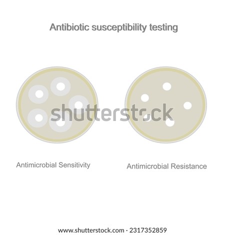 The result of Antibiotic susceptibility testing : Antimicrobial Sensitivity and Resistance for determine the microbial (bacteria or fungus) growth with antibiotic drugs pad.