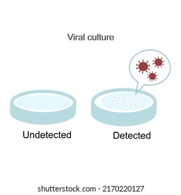 The result interpretation of viral culture for diagnosis the pathogen infection : Detected and undetected