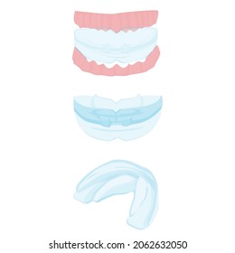 Retainer For Teeth At Different Angles Isolated On White Background. Mouthguard On The Teeth. Orthodontic Retainer On The Human Jaw. Teeth Straightening Tools. Dentistry. Vector Flat.