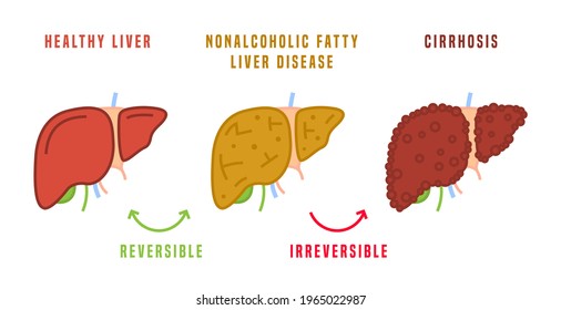 Liver disease svg